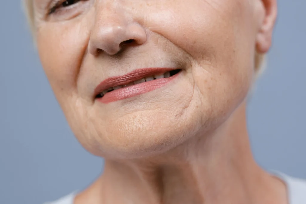 Close-up shot of an old woman after facelift surgery.