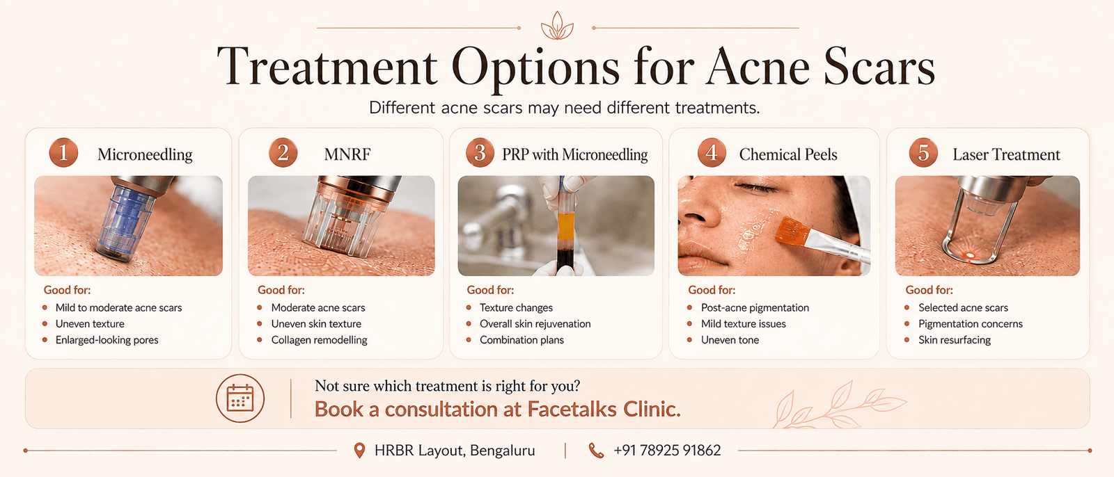 Acne scar treatment options including microneedling, MNRF, PRP with microneedling, chemical peels and laser treatment at Facetalks Clinic Bangalore.