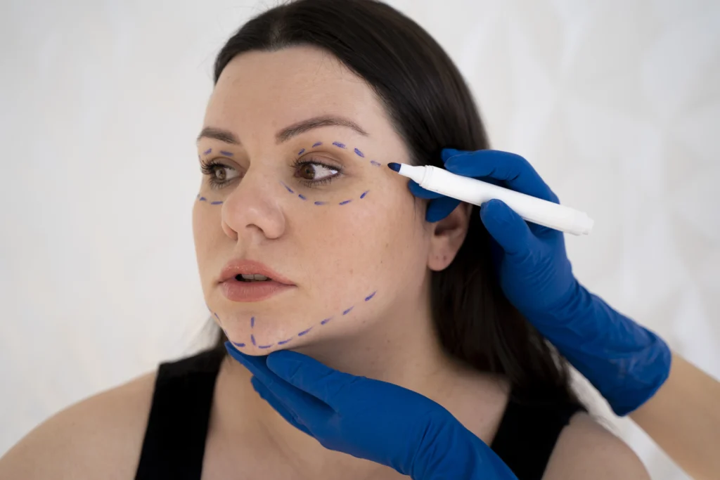 Doctor planning a facelift surgery.