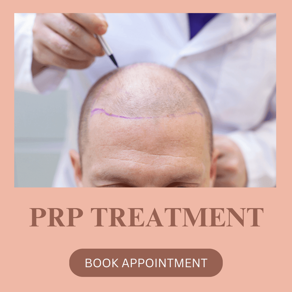 PRP Treatment