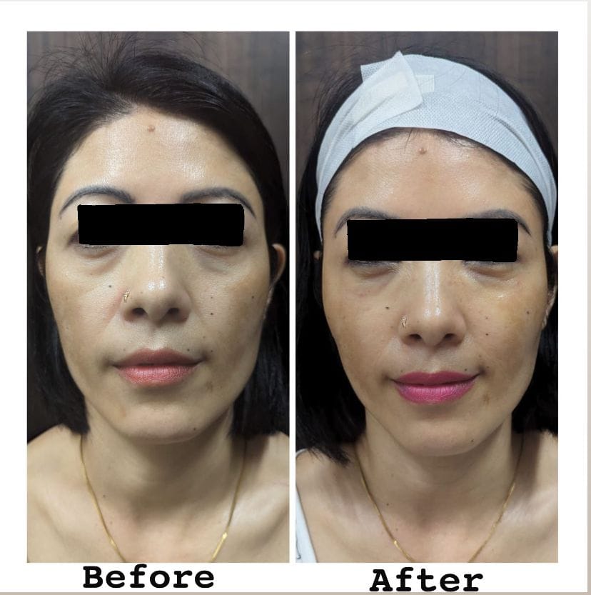 WhatsApp Image 2024-07-18 at 3.14.02 PM (1)