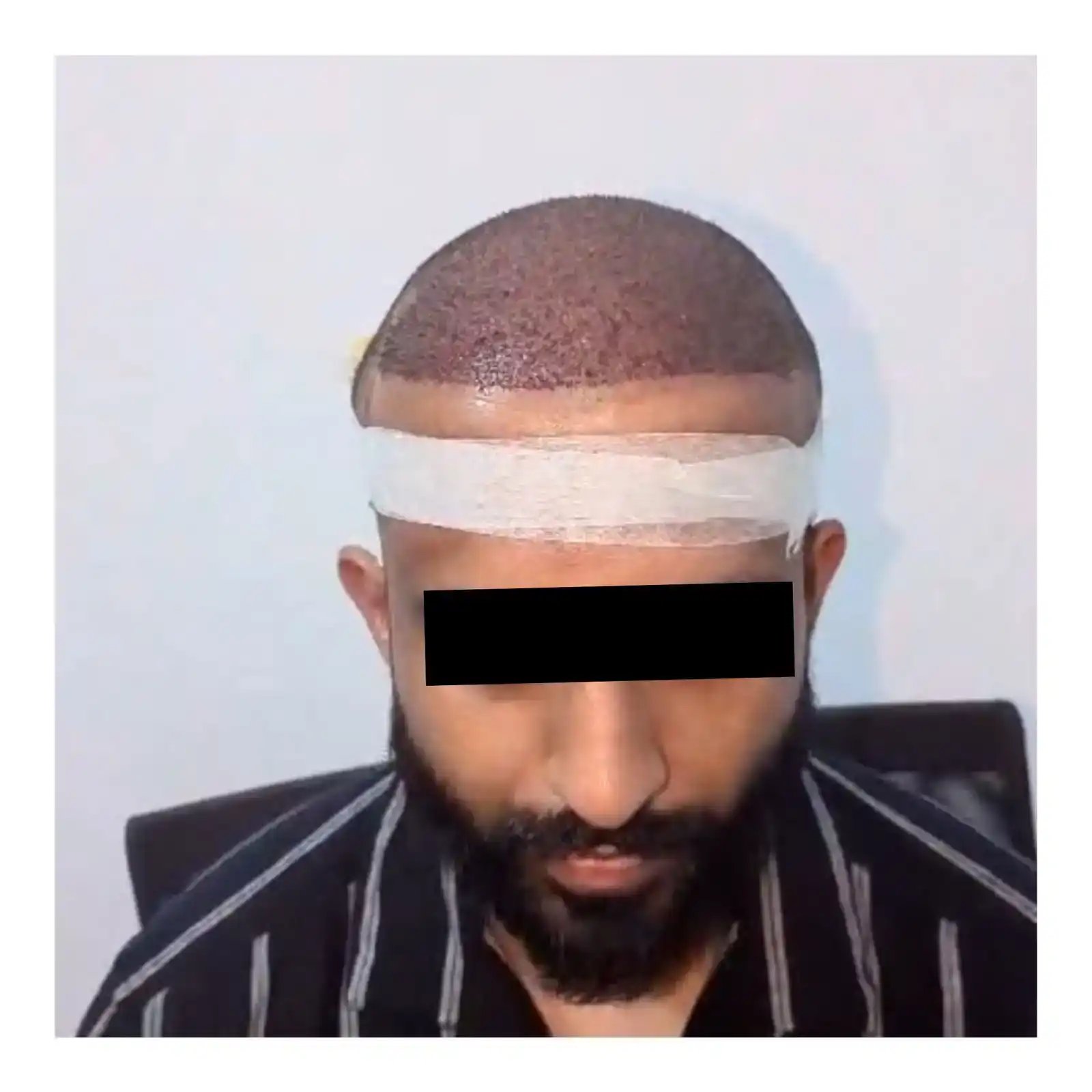 botox, fillers, PRP treatment, GFC