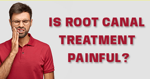 Root canal in Bangalore