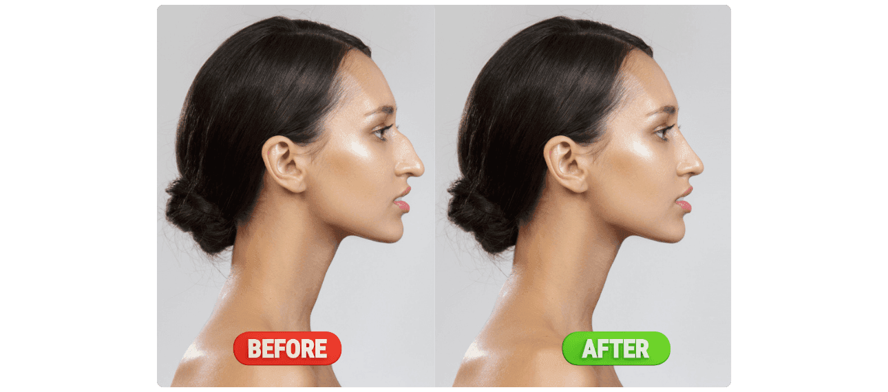 Rhino_beforeafter1_d7c15a4bdb