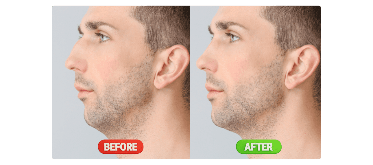 Rhino_beforeafter2_e99ad7ec34