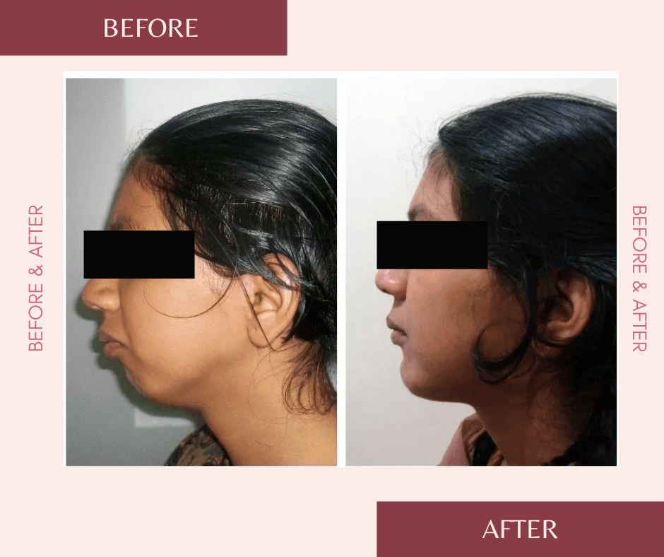 Before and After Minimal Photocentric facebook post