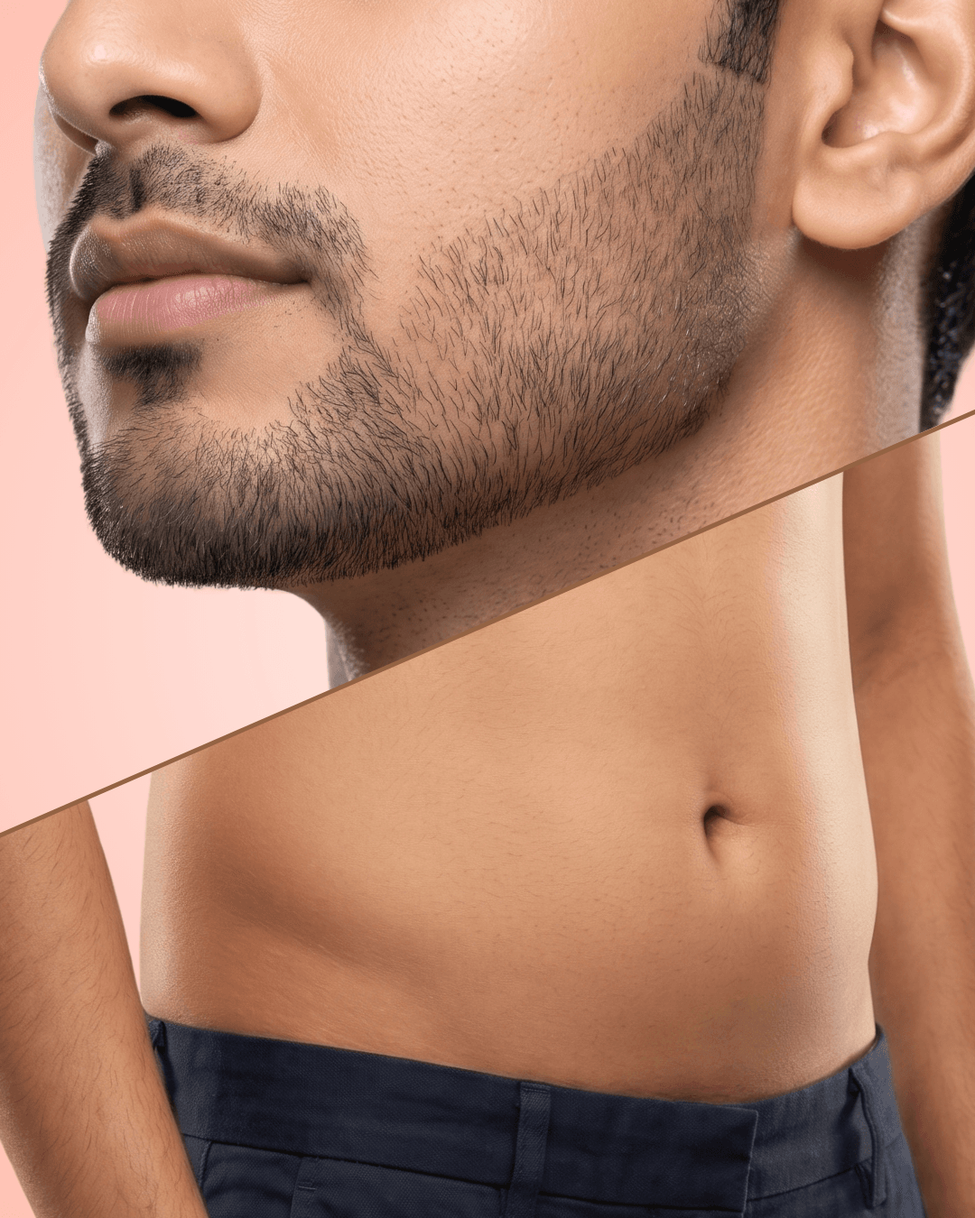Custom laser hair removal areas including beard shaping and stomach hair reduction